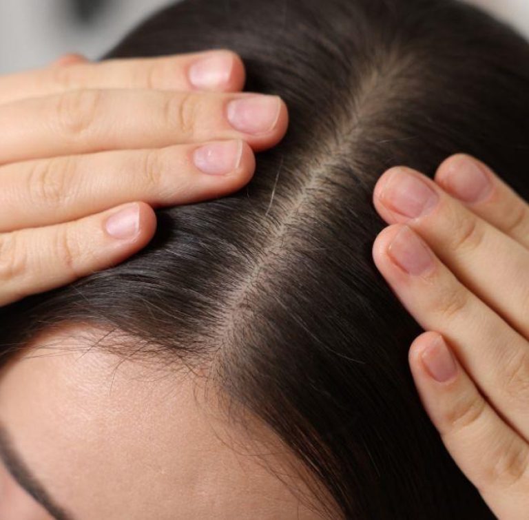 scalp health